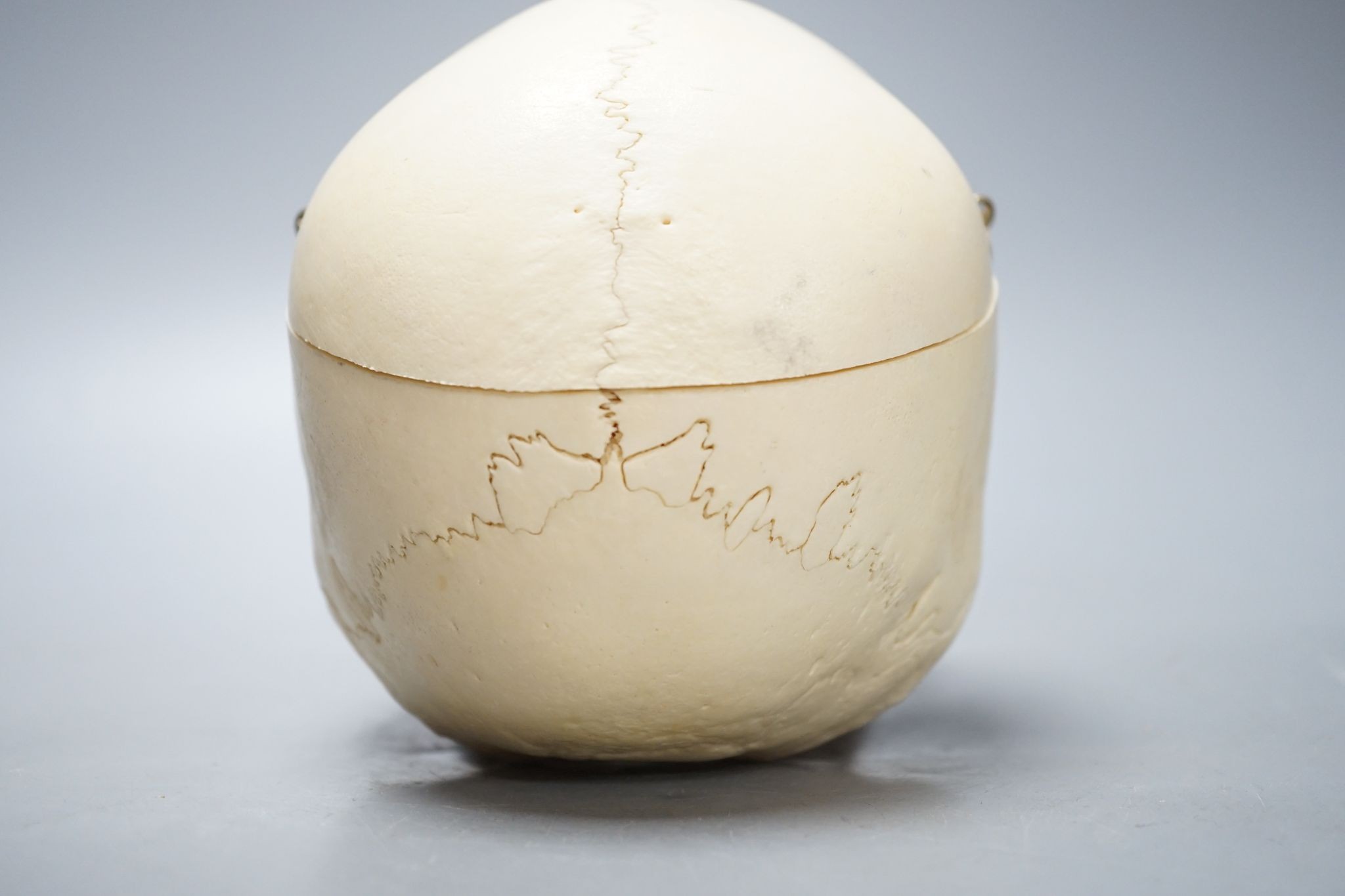 A human skull, acquired c.1976., 14 cms high x 19.5 wide.